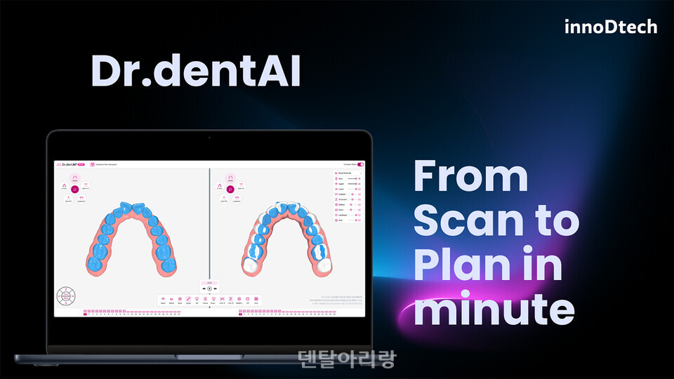 이노디테크, ‘DENTECH CHINA 2025’ 참가